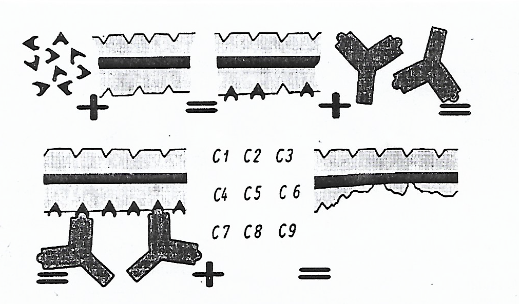 Haptènes + myéline = myéline recouverte + anticorps + complément (C1–C9) = destruction de myéline
